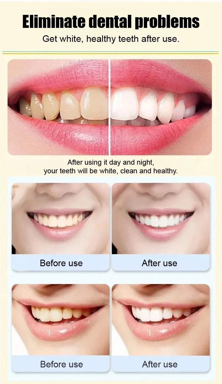 SP-6 Toothpaste Oral Health Management. Fresh Breath