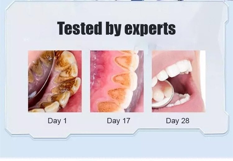 SP-6 Toothpaste Oral Health Management. Fresh Breath